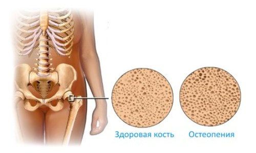 Кость под микроскопом