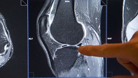 Рентген-снимок колена