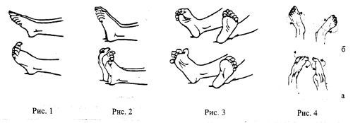 Гимнастика для стопы