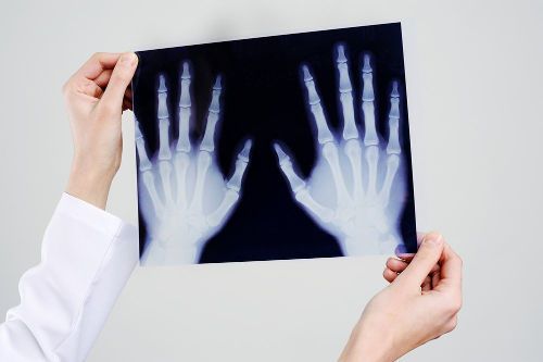 Рентген-снимок рук
