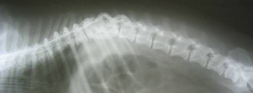 Рентгенограмма позвоночника