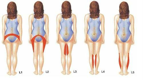 Нарушение чувствительности при грыже поясничного отдела