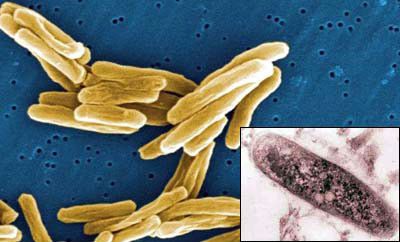 Микобактерии туберкулеза