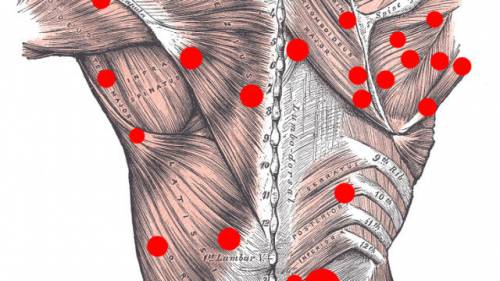 Триггерные точки спины
