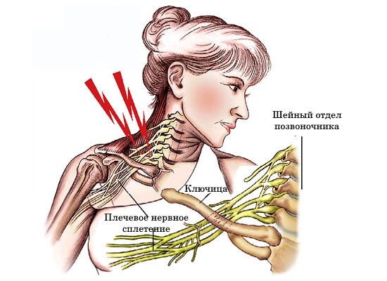 Плечевой нерв