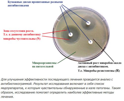 Антибиотикограмма