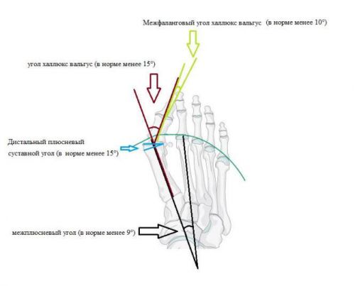 Схема углов между пальцами ноги