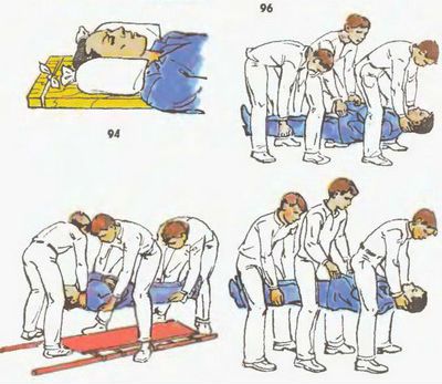Транспортировка пациента с травмой позвоночника