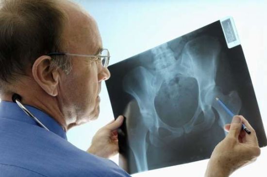 Рентген-снимок тазобедренного сустава