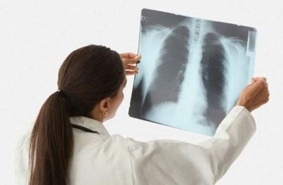 Оценка рентген-снимка грудной клетки