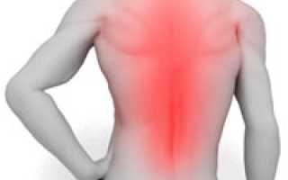 Как лечить боль в спине чтобы она быстрее прошла?