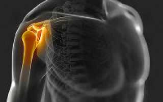 Строение плечевого сустава и его заболевания