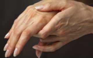 Возможные причины боли в суставах пальцев рук