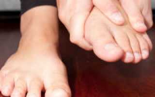 Лечение отложения солей в стопах ног