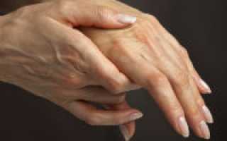 Главные причины боли в суставах пальцев рук