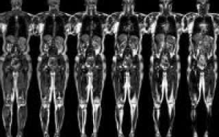 Магнитно-резонансная томография (МРТ) пояснично-крестцового отдела