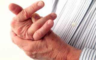 Почему плохо разгибается палец на руке