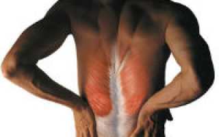 Мышечная боль в спине и ее лечение