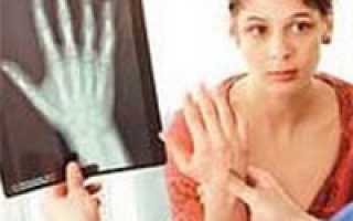 Особенности остеопороза у женщин и его лечение