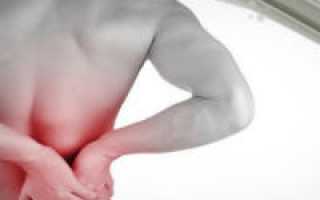 Что такое невралгия спины и чем ее лечить