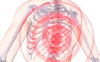 Признаки хондроза грудного отдела позвоночника