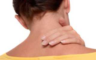 Причины, симптомы и способы лечения шейного миозита