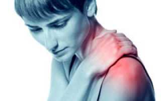 Артрит плечевого сустава и его лечение