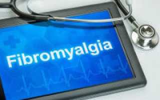 Синдром фибромиалгии