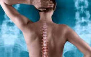 Признаки дорсопатии грудного отдела позвоночного столба