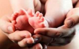 Гемолитическая желтуха у новорожденных детей