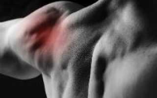 Симптомы вывиха плеча и способы его лечения