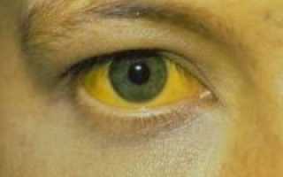 Дифференциальная диагностика желтухи