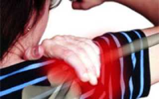 Бурсит плечевого сустава и способы его лечения
