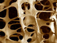 Костная ткань при остеопорозе