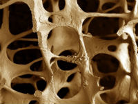 Структура кости при остеопорозе